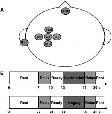 Subjective Vividness of Kinesthetic Motor Imagery Is Associated With the Similarity in Magnitude of Sensorimotor Event-Related Desynchronization Between Motor Execution and Motor Imagery